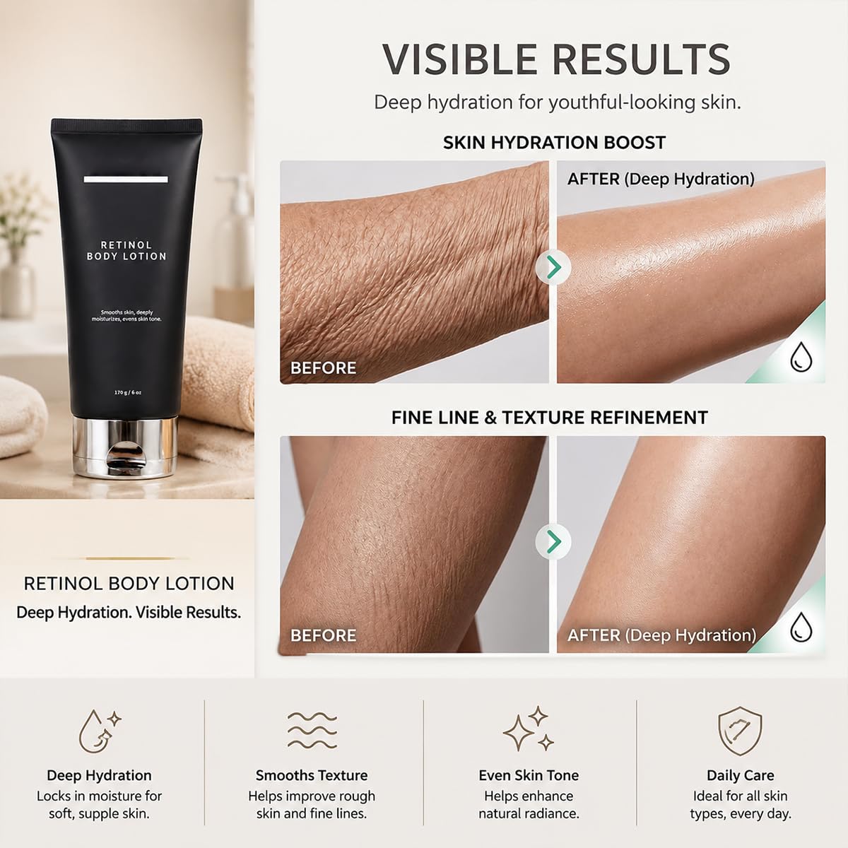 Retinol Body Lotion, Firming Body Cream for Crepey Skin, Moisturizing Anti-Aging Lotion for Neck, Arms, Legs & Full Body Skin Care, 170g