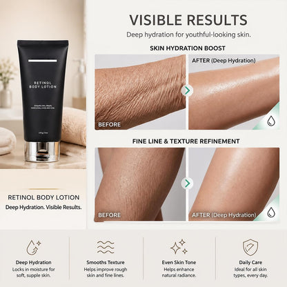 Retinol Body Lotion, Firming Body Cream for Crepey Skin, Moisturizing Anti-Aging Lotion for Neck, Arms, Legs & Full Body Skin Care, 170g